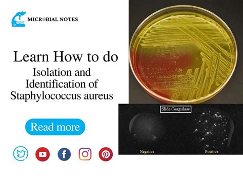 Identification and Characterization of Staphylococcus aureus .